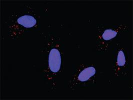 Anti-PRKCD + GRM5 Antibody Pair