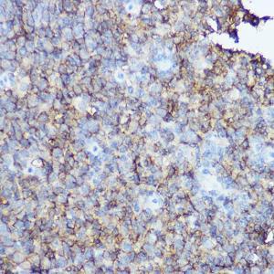 Immunohistochemistry analysis of paraffin-embedded human tonsil using Anti-CD20 Antibody (A11482) at a dilution of 1:100 (40x lens) Perform high pressure antigen retrieval with 10 mM citrate buffer pH 60 before commencing with IHC staining protocol