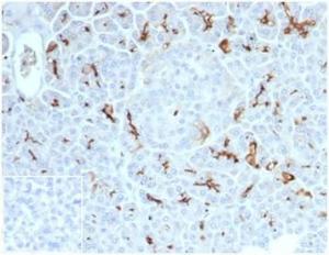 Anti-CFTR Rabbit Recombinant Antibody [clone: CFTR/7154R]