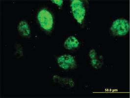 Anti-SPI1 Mouse Monoclonal Antibody [clone: 2G1]