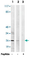 Anti-LDLRAD1 Rabbit Polyclonal Antibody