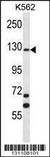 Anti-MCF2 Rabbit Polyclonal Antibody (HRP (Horseradish Peroxidase))