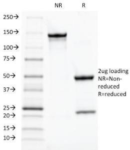 SDS-PAGE analysis of Anti-TOX3 Antibody [TOX3/1124] under non-reduced and reduced conditions; showing intact IgG and intact heavy and light chains, respectively. SDS-PAGE analysis confirms the integrity and purity of the Antibody