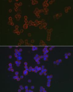 Immunofluorescence analysis of Raji cells using Anti-CD20 Antibody (A11482) at a dilution of 1:100 (40x lens) DAPI was used to stain the cell nuclei (blue)