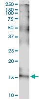 Anti-IL15 Polyclonal Antibody Pair