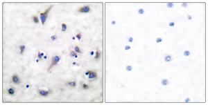 Immunohistochemical analysis of paraffin-embedded human brain using Anti-DARPP-32 (phospho Thr34) Antibody. The right hand panel represents a negative control, where the antibody was pre-incubated with the immunising peptide.