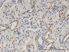 Anti-SP140 Mouse Monoclonal Antibody [clone: 3F9]