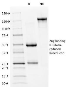 SDS-PAGE analysis of Anti-p53 Antibody [PAb240] under non-reduced and reduced conditions; showing intact IgG and intact heavy and light chains, respectively. SDS-PAGE analysis confirms the integrity and purity of the antibody.