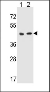 Anti-HTR4 Rabbit Polyclonal Antibody (AP (Alkaline Phosphatase))