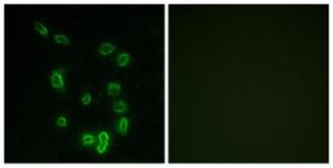 Immunofluorescence analysis of HepG2 cells using Anti-DARPP-32 (phospho Thr34) Antibody. The right hand panel represents a negative control, where the antibody was pre-incubated with the immunising peptide.