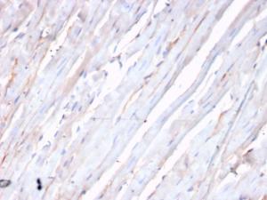 Immunohistochemical analysis of formalin-fixed, paraffin-embedded human heart using Anti-N Cadherin Antibody [CDH2/3874R]