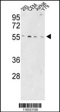 Anti-SOX4 Rabbit Polyclonal Antibody