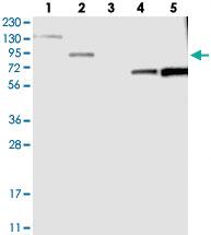 Anti-PPM1E Rabbit Polyclonal Antibody