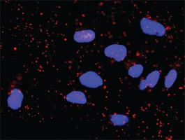 Anti-CCNE1 + GSK3B Antibody Pair