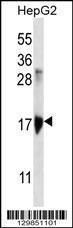 Anti-KRTAP1-3 Rabbit Polyclonal Antibody (HRP (Horseradish Peroxidase))