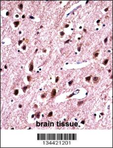 Anti-SNRPN Rabbit Polyclonal Antibody (FITC (Fluorescein Isothiocyanate))