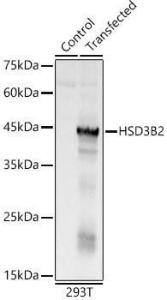 Antibody anti-HSD3B2 100 µl