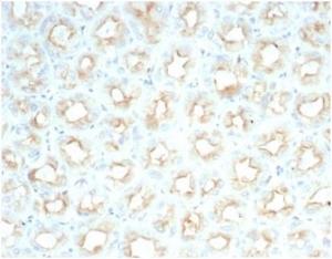 Anti-CFTR Rabbit Recombinant Antibody [clone: CFTR/7154R]