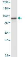 Anti-FBXL18 Rabbit Polyclonal Antibody