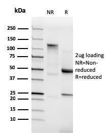 SDS-PAGE analysis of Anti-N Cadherin Antibody [CDH2/3874R] under non-reduced and reduced conditions; showing intact IgG and intact heavy and light chains, respectively. SDS-PAGE analysis confirms the integrity and purity of the Antibody