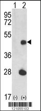 Anti-LUC7L Rabbit Polyclonal Antibody