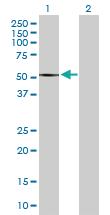 Anti-SMYD2 Rabbit Polyclonal Antibody