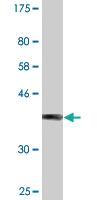 Anti-WBSCR22 Mouse Monoclonal Antibody [clone: 2E12]