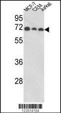 Anti-ABI1 Rabbit Polyclonal Antibody (PE (Phycoerythrin))