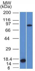 Western blot analysis of recombinant Factor XIIIa protein and HeLa cell lysate using Anti-Factor XIIIa Antibody [F13A1/1448]