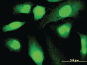 Anti-SP140 Mouse Monoclonal Antibody [clone: 3F9]