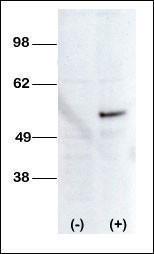 Anti-STK38L Rabbit Polyclonal Antibody (FITC (Fluorescein))