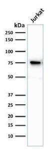 Anti-Moesin antibody