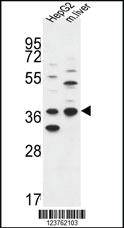 Anti-DHRS3 Rabbit Polyclonal Antibody