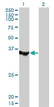 Anti-MTMR1 Mouse Monoclonal Antibody [clone: 1F10]