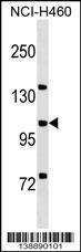 Anti-MCF2L Rabbit Polyclonal Antibody (FITC (Fluorescein Isothiocyanate))