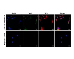 Cytoplasmic expression of NF-H (red) and membrane TrkC expression (green) in human HeLa cells