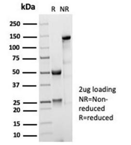 SDS-PAGE analysis of Anti-CD35 Antibody [CR1/7016R] under non-reduced and reduced conditions; showing intact IgG and intact heavy and light chains, respectively. SDS-PAGE analysis confirms the integrity and purity of the antibody.