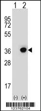 Anti-DHRS3 Rabbit Polyclonal Antibody