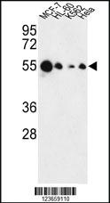 Anti-ZSCAN22 Rabbit Polyclonal Antibody