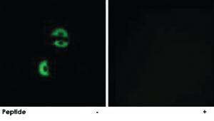 Anti-LDLRAD3 Rabbit Polyclonal Antibody