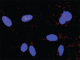 Anti-TP53 + MAPK1 Antibody Pair