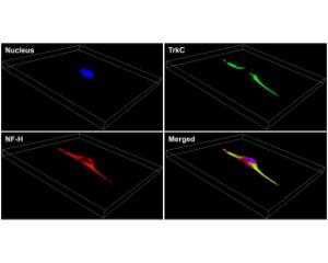 3D confocal imaging of membrane TrkC expression (green) in human HeLa cell