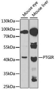 Anti-Prostacyclin receptor Rabbit Polyclonal Antibody