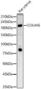 Western blot analysis of Rat uterus, using Anti-Collagen IV alpha 6 Antibody (A309843) at 1:400 dilution. The secondary antibody was Goat Anti-Rabbit IgG H&L Antibody (HRP) at 1:10,000 dilution.