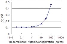 Anti-ATP6V0D1 Mouse Monoclonal Antibody [clone: 3B7]