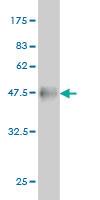 Anti-RTN2 Mouse Monoclonal Antibody [clone: 6A11]