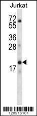 Anti-KRTAP13-3 Rabbit Polyclonal Antibody (FITC (Fluorescein Isothiocyanate))