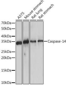 Western blot analysis of extracts of various cell lines, using Anti-Caspase-14 Antibody [ARC1661] (A305978) at 1:1,000 dilution. The secondary antibody was Goat Anti-Rabbit IgG H&L Antibody (HRP) at 1:10,000 dilution.