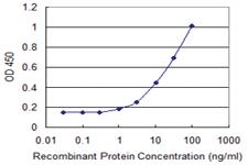 Anti-MTMR1 Mouse Monoclonal Antibody [clone: 1F10]