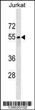 Anti-SEPT6 Rabbit Polyclonal Antibody (HRP (Horseradish Peroxidase))